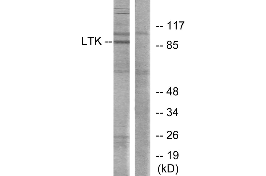 Western Blot - Anti-LTK Antibody (C10512) - Antibodies.com