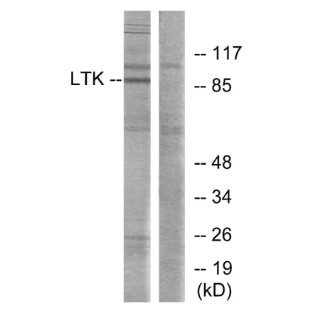 Western Blot - Anti-LTK Antibody (C10512) - Antibodies.com