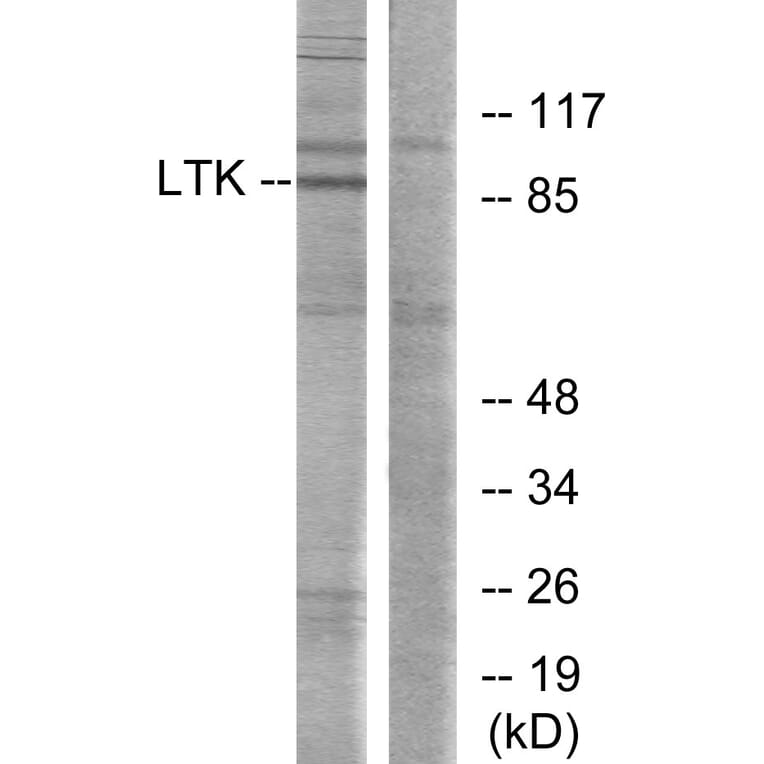 Western Blot - Anti-LTK Antibody (C10512) - Antibodies.com