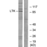 Western Blot - Anti-LTK Antibody (C10512) - Antibodies.com