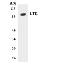 Western Blot - Anti-LTK Antibody (R12-2979) - Antibodies.com