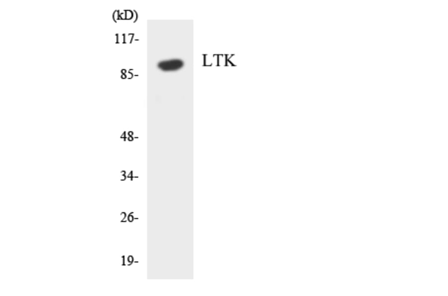 Western Blot - Anti-LTK Antibody (R12-2979) - Antibodies.com