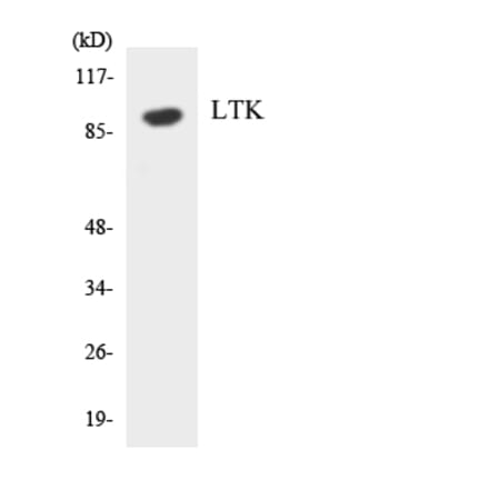 Western Blot - Anti-LTK Antibody (R12-2979) - Antibodies.com