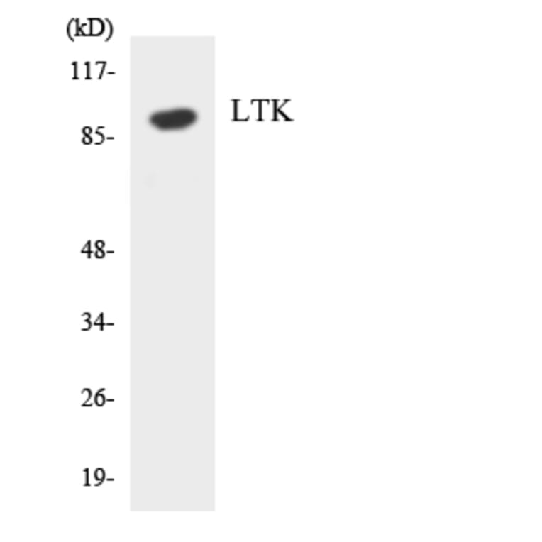 Western Blot - Anti-LTK Antibody (R12-2979) - Antibodies.com