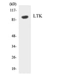 Western Blot - Anti-LTK Antibody (R12-2979) - Antibodies.com