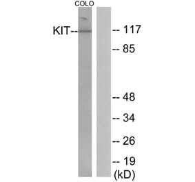 Western Blot - Anti-KIT Antibody (B0501) - Antibodies.com