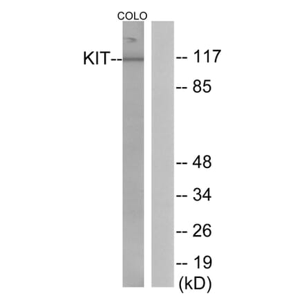 Western Blot - Anti-KIT Antibody (B0501) - Antibodies.com