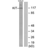 Western Blot - Anti-KIT Antibody (B0501) - Antibodies.com