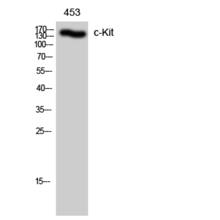 Western Blot - Anti-KIT Antibody (B0501) - Antibodies.com