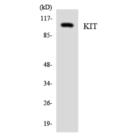 Western Blot - Anti-KIT Antibody (R12-2953) - Antibodies.com