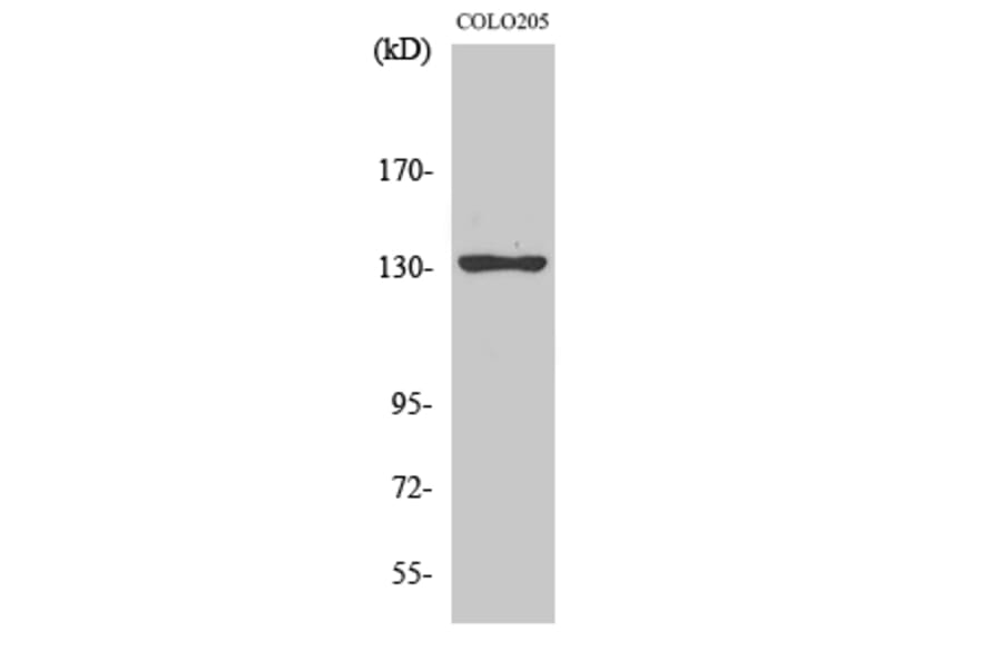 Western Blot - Anti-JMY Antibody (C10003) - Antibodies.com