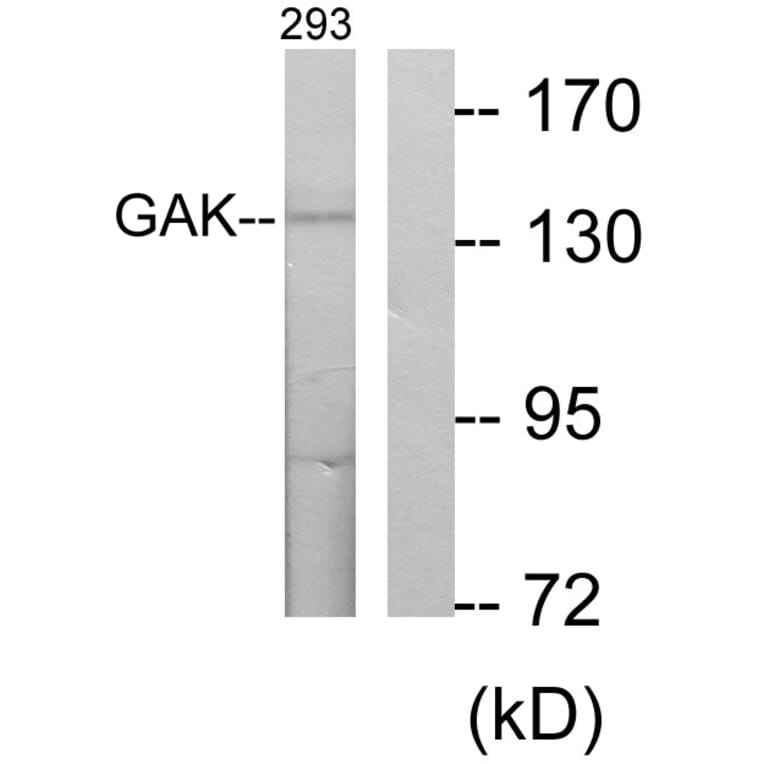 Western Blot - Anti-GAK Antibody (C10064) - Antibodies.com