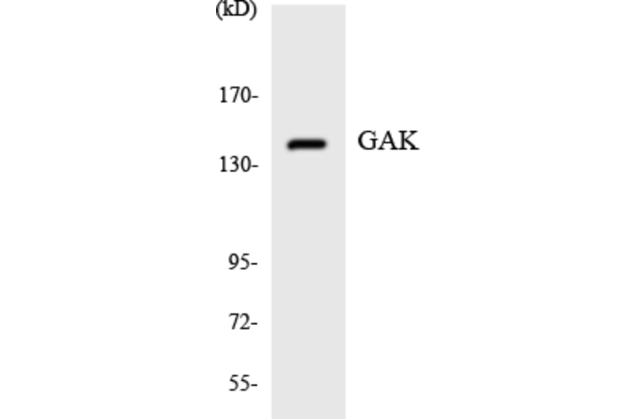 Western Blot - Anti-GAK Antibody (R12-2794) - Antibodies.com