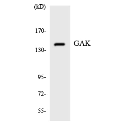 Western Blot - Anti-GAK Antibody (R12-2794) - Antibodies.com