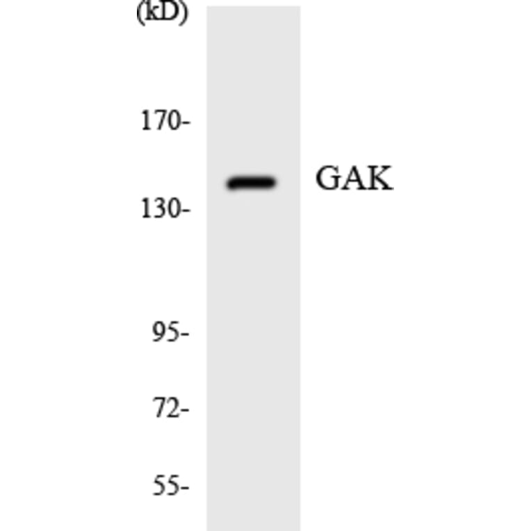 Western Blot - Anti-GAK Antibody (R12-2794) - Antibodies.com