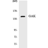 Western Blot - Anti-GAK Antibody (R12-2794) - Antibodies.com