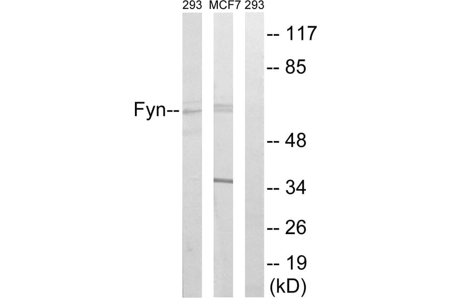Western Blot - Anti-Fyn Antibody (B0430) - Antibodies.com