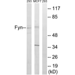 Western Blot - Anti-Fyn Antibody (B0430) - Antibodies.com