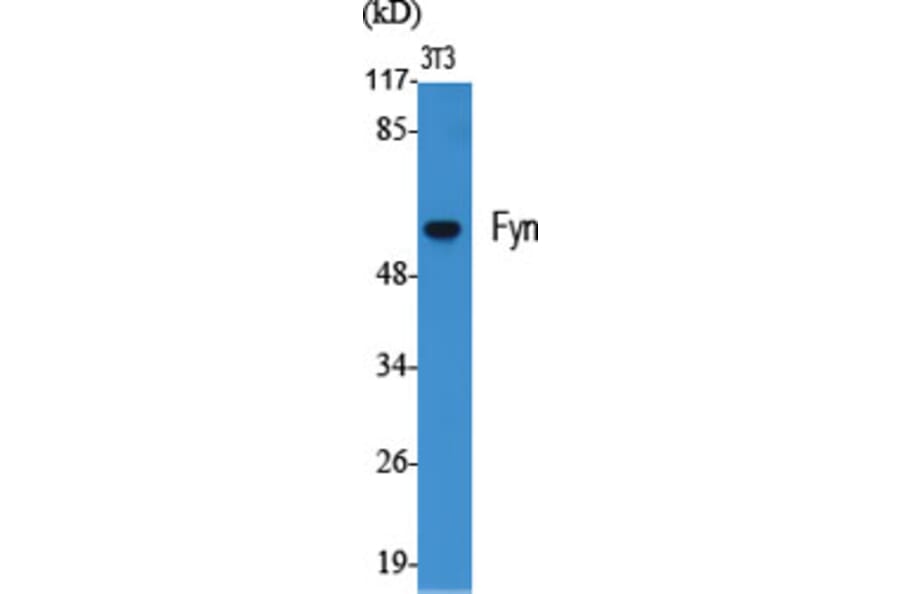 Western Blot - Anti-Fyn Antibody (B0430) - Antibodies.com