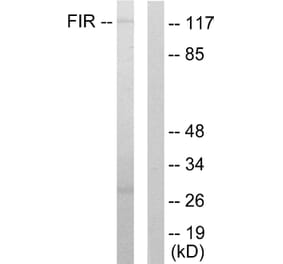 Western Blot - Anti-FIR Antibody (C10207) - Antibodies.com