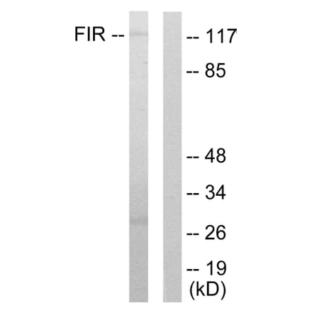 Western Blot - Anti-FIR Antibody (C10207) - Antibodies.com