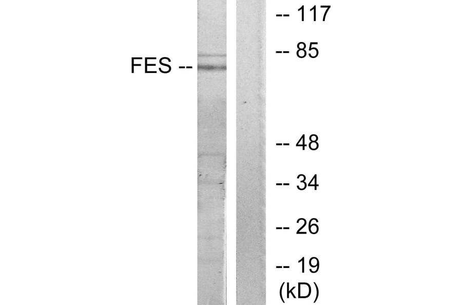 Western Blot - Anti-FES Antibody (C10294) - Antibodies.com