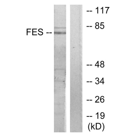 Western Blot - Anti-FES Antibody (C10294) - Antibodies.com