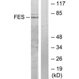 Western Blot - Anti-FES Antibody (C10294) - Antibodies.com