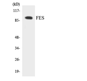 Western Blot - Anti-FES Antibody (R12-2768) - Antibodies.com