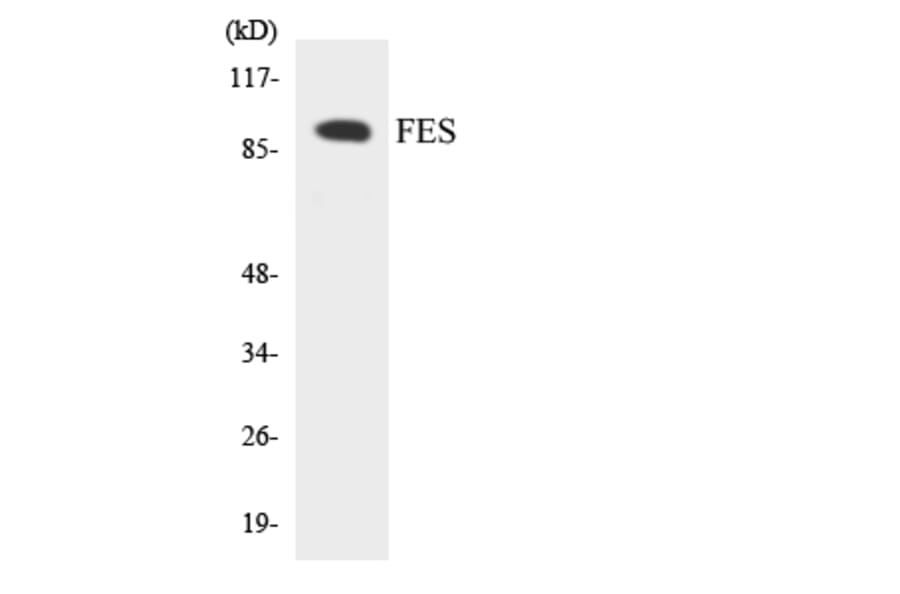 Western Blot - Anti-FES Antibody (R12-2768) - Antibodies.com