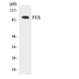 Western Blot - Anti-FES Antibody (R12-2768) - Antibodies.com