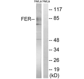 Western Blot - Anti-FER Antibody (B8100) - Antibodies.com
