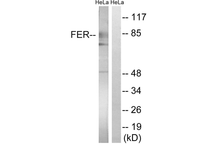Western Blot - Anti-FER Antibody (B8100) - Antibodies.com
