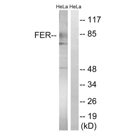 Western Blot - Anti-FER Antibody (B8100) - Antibodies.com