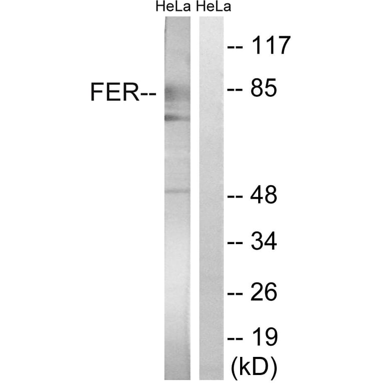 Western Blot - Anti-FER Antibody (B8100) - Antibodies.com