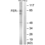 Western Blot - Anti-FER Antibody (B8100) - Antibodies.com