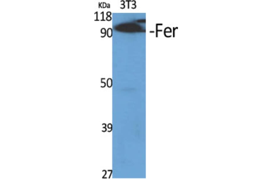 Western Blot - Anti-FER Antibody (B8100) - Antibodies.com