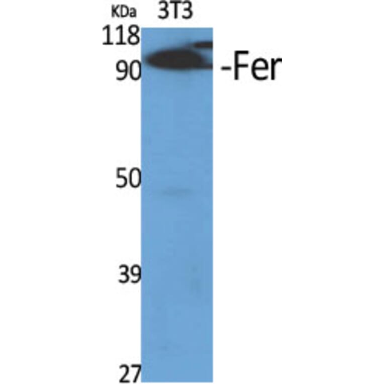 Western Blot - Anti-FER Antibody (B8100) - Antibodies.com