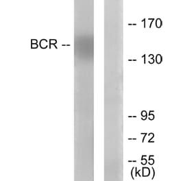 Western Blot - Anti-Bcr Antibody (B7028) - Antibodies.com