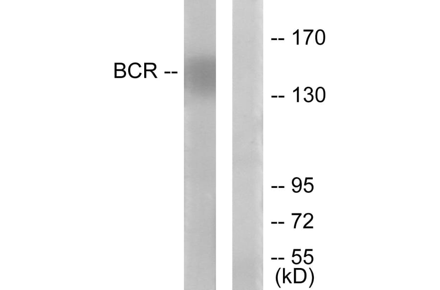 Western Blot - Anti-Bcr Antibody (B7028) - Antibodies.com