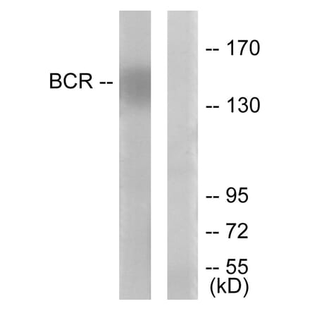 Western Blot - Anti-Bcr Antibody (B7028) - Antibodies.com