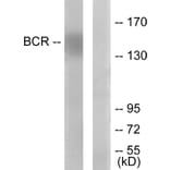 Western Blot - Anti-Bcr Antibody (B7028) - Antibodies.com