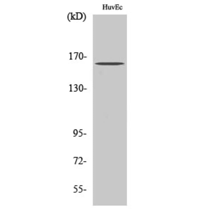 Western Blot - Anti-Bcr Antibody (B7028) - Antibodies.com