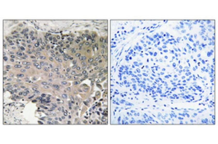 Immunohistochemistry - Anti-Bcr Antibody (B7028) - Antibodies.com