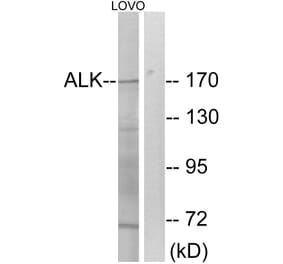 Western Blot - Anti-ALK Antibody (B0611) - Antibodies.com