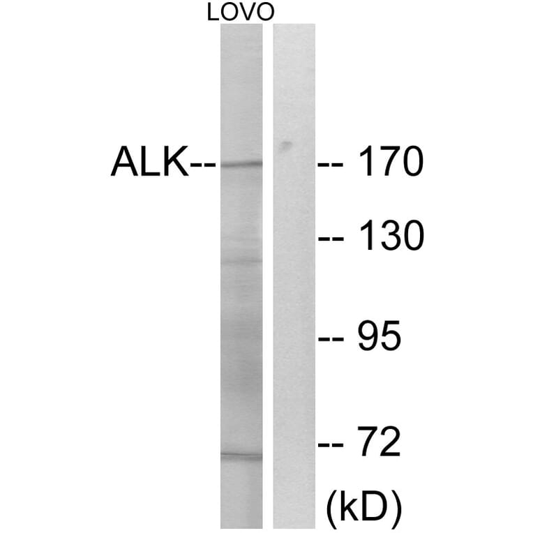 Western Blot - Anti-ALK Antibody (B0611) - Antibodies.com