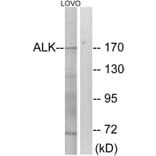 Western Blot - Anti-ALK Antibody (B0611) - Antibodies.com