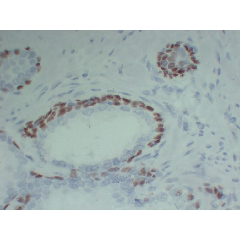 Immunohistochemistry - Anti-p63 Antibody (V0107) - Antibodies.com