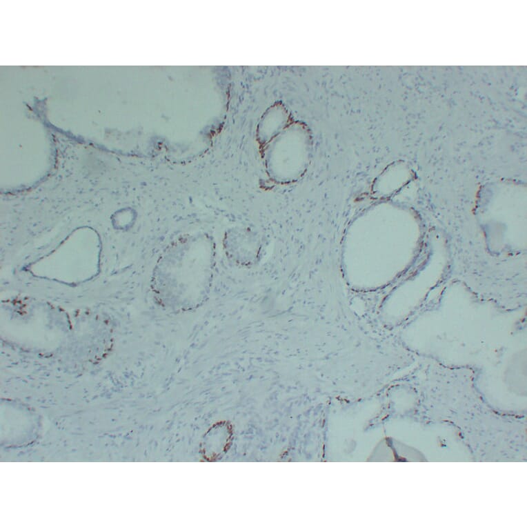 Immunohistochemistry - Anti-p63 Antibody (V0107) - Antibodies.com