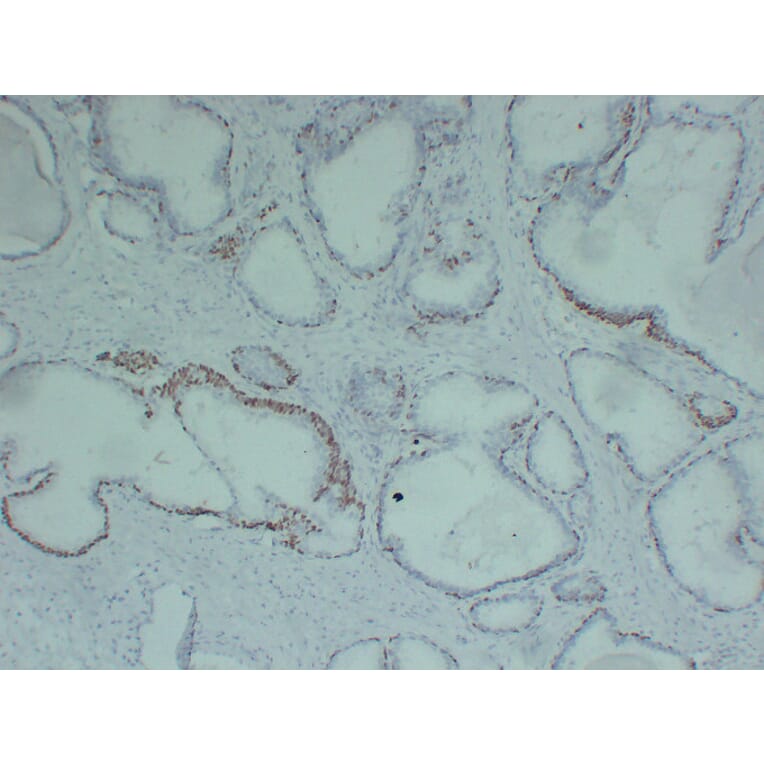 Immunohistochemistry - Anti-p63 Antibody (V0107) - Antibodies.com